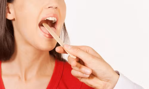 Chữa viêm họng. Dùng rau má tươi rửa sạch và giã nát ép lấy nước hòa với chút nước ấm để uống trong ngày. Những người bị xuất huyết còn có thể uống nước rau má tươi để cầm máu. Ảnh: Vimduonghohap.