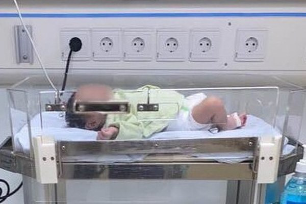 Nu hon khien be so sinh nhap vien, nhung tiep xuc nao can tranh?