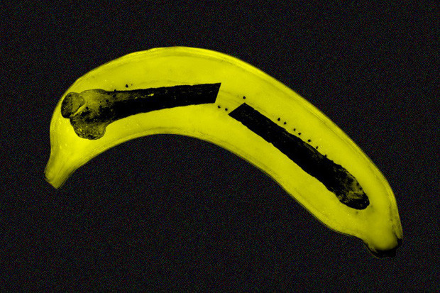 Hai quy ong gay duong vat: Sau phau thuat, “sinh hoat” the nao?