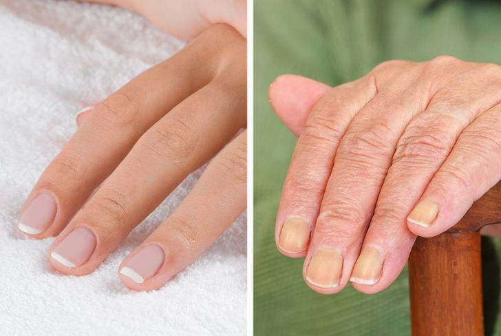 Móng tay là thước đo sức khỏe tổng thể và chúng phản ánh những thay đổi xảy ra trong cơ thể theo thời gian. Khi bạn già đi, móng tay sẽ mọc chậm hơn và giòn, dễ gãy hơn.
