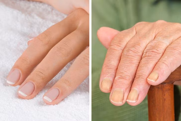 Móng tay là thước đo sức khỏe tổng thể và chúng phản ánh những thay đổi xảy ra trong cơ thể theo thời gian. Khi bạn già đi, móng tay sẽ mọc chậm hơn và giòn, dễ gãy hơn.