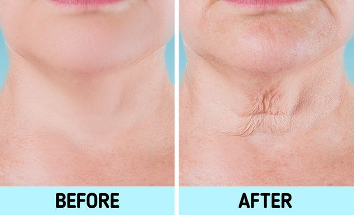 Cổ: Một trong những dấu hiệu lão hóa ở cổ dễ nhận thấy là sự xuất hiện của các dải cơ dọc. Ngoài ra, cổ có thể xuất hiện những đốm nâu khi bạn già đi. Chúng có thể phát triển do ảnh hưởng có hại của ánh nắng mặt trời, yếu tố di truyền hoặc các vấn đề sức khỏe khác như béo phì.