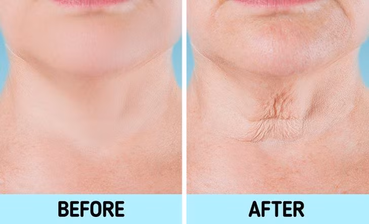 Cổ: Một trong những dấu hiệu lão hóa ở cổ dễ nhận thấy là sự xuất hiện của các dải cơ dọc. Ngoài ra, cổ có thể xuất hiện những đốm nâu khi bạn già đi. Chúng có thể phát triển do ảnh hưởng có hại của ánh nắng mặt trời, yếu tố di truyền hoặc các vấn đề sức khỏe khác như béo phì.