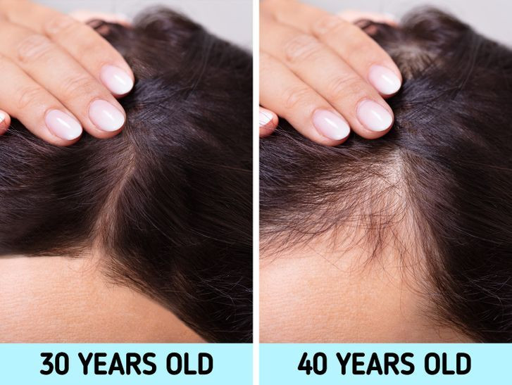 Tóc: Khi bạn già đi, tóc không chỉ bạc màu mà còn dễ rụng hơn. Nguyên nhân là lưu lượng máu ở da đầu và xung quanh nang tóc giảm dần, khiến tóc ít nhận được oxy và các vitamin thiết yếu. Bạn nên tích cực massage da đầu và bổ sung vitamin cho cơ thể để giảm thiểu tình trạng này. Ảnh: BS.