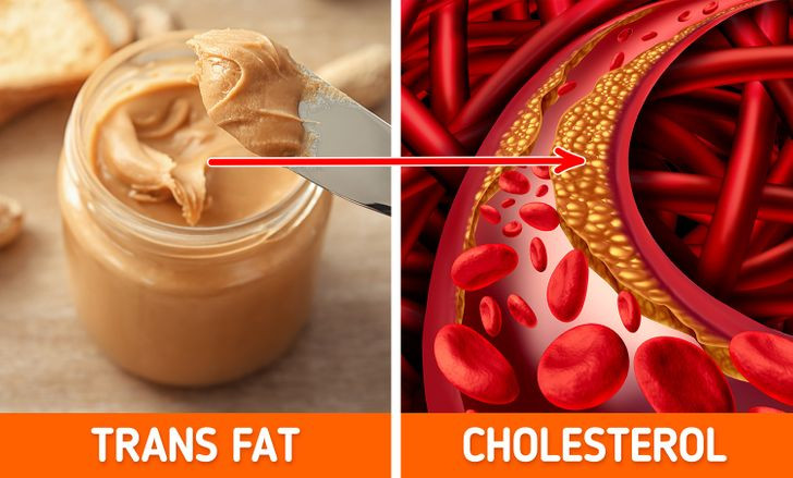 10. Bơ đậu phộng: Theo các chuyên gia dinh dưỡng, mặc dù bơ đậu phộng nguyên bản chứa nhiều thành phần hữu ích, nhưng loại được bán ở đa số các cửa hàng có thể gây hại. Điều này là do loại bơ hạt này chứa các thành phần bổ sung như chất béo chuyển hóa, dầu thực vật và nhiều đường. Các chuyên gia dinh dưỡng chọn bơ đậu phộng từ các cửa hàng thực phẩm tốt cho sức khỏe hơn là mua từ siêu thị thông thường. Ảnh: BS.