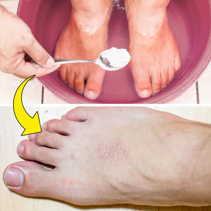 8. Tắm bằng baking soda để giảm đau: Tắm bằng baking soda thường được sử dụng để điều trị một số tình trạng sức khỏe, từ giảm căng thẳng và đau đớn đến tăng cường tuần hoàn. Nhưng mức độ kiềm của nó có thể làm hỏng và gây kích ứng da. Ảnh: BS.