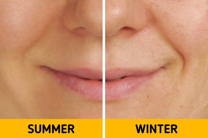 5. Xuất hiện các nếp nhăn: Da của chúng ta thường dễ bị tổn thương hơn vào mùa lạnh. Bởi độ ẩm trong không khí giảm trong những tháng lạnh, tuần hoàn máu chậm hơn, da của bạn trở nên khô hơn. Nó không thể giữ đủ nước và kết quả là da bị khô và dễ nhăn hơn.