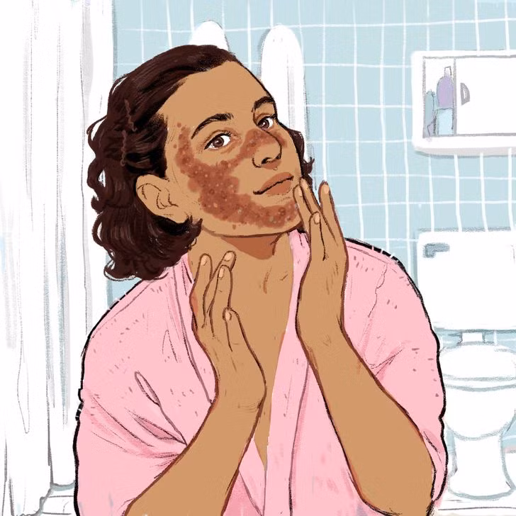 Tẩy tế bào chết: Bạn không nên tẩy da chết hàng ngày mà chỉ thực hiện 1-2 lần/tuần. Đây là bước loại bỏ các tế bào da chết và tái tạo kết cấu đồng nhất cho da mặt. Có nhiều sản phẩm tẩy da chết gồm: chất cơ học chứa các hạt nhỏ để loại bỏ tế bào chết bằng ma sát; hoặc dung dịch hóa học được thoa lên da mặt và chờ đến lúc khô để lớp da cũ bong ra.