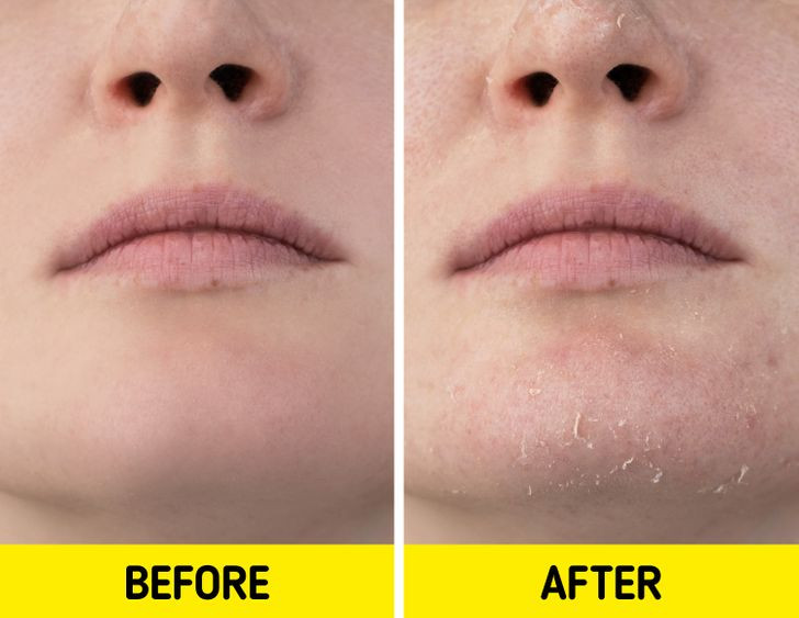 Ly do vi sao ban khong nen mac do ngu qua am ke ca mua dong-Hinh-3