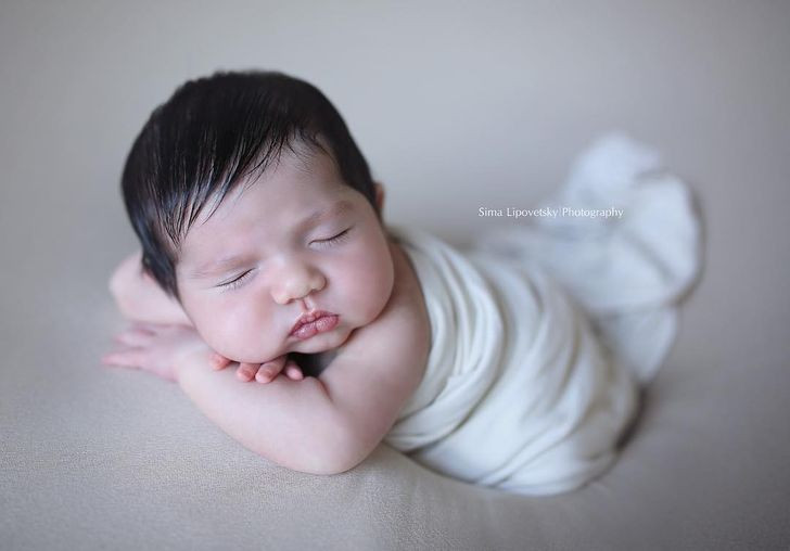 Khuôn mặt phúng phính đáng yêu của cậu bé trông như hai chiếc bánh bao tròn trịa.