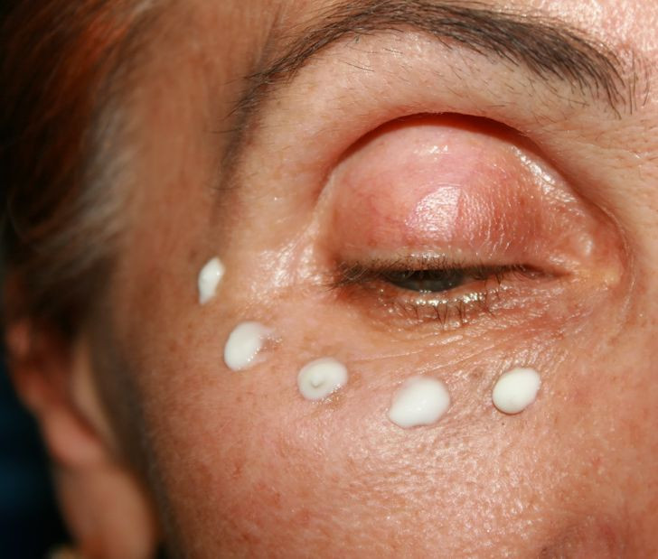 6. Bôi kem dưỡng ẩm: Dưỡng ẩm cho khuôn mặt của bạn với các loại dầu và kem dưỡng ẩm giúp làm mờ các vết nhăn và quầng thâm. Động tác mát-xa khi bôi kem dưỡng ẩm cũng giúp máu lưu thông tốt hơn, do đó tránh sự tích tụ hoặc co thắt trong mạch máu. Bạn có thể chọn kem dưỡng ẩm hàng ngày như kem Vitamin E hoặc C, dầu hạnh nhân và dầu dừa. Ảnh: BS.