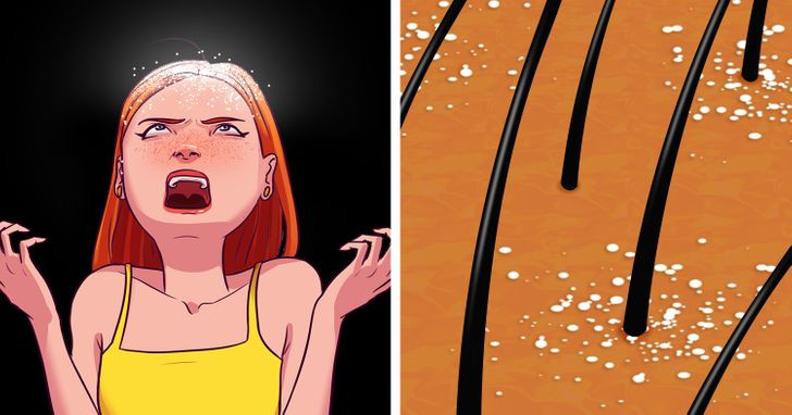 6. Do bạn quá căng thẳng: Khi chúng ta căng thẳng, hệ thống miễn dịch sẽ bị ảnh hưởng và điều này có thể khuyến khích sự phát triển của dầu và nấm sản sinh. Thỉnh thoảng hãy đi bộ để giải tỏa suy nghĩ, tập yoga hoặc ngâm mình trong bồn nước ấm. Điều này sẽ giúp bạn thư giãn hiệu quả hơn.