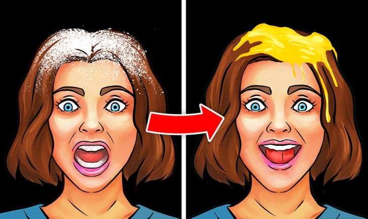 9. Do không dưỡng ẩm đủ cho da đầu: Da đầu của bạn vẫn giống như các vùng da khác trên cơ thể bạn và nó cũng cần được chăm sóc. Da đầu khô có thể bong tróc và ngứa, vì vậy, hãy dưỡng ẩm cho tóc bằng hỗn hợp lòng đỏ trứng, sữa chua, chanh và mật ong. Ủ tóc tóc với hỗn hợp này, sau đó gội sạch bằng dầu gội