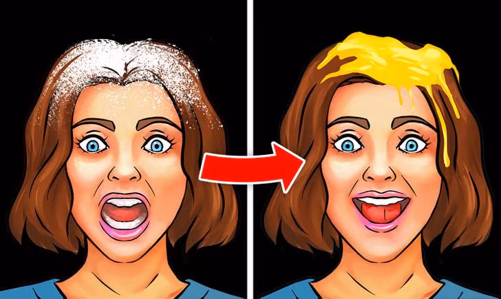 9. Do không dưỡng ẩm đủ cho da đầu: Da đầu của bạn vẫn giống như các vùng da khác trên cơ thể bạn và nó cũng cần được chăm sóc. Da đầu khô có thể bong tróc và ngứa, vì vậy, hãy dưỡng ẩm cho tóc bằng hỗn hợp lòng đỏ trứng, sữa chua, chanh và mật ong. Ủ tóc tóc với hỗn hợp này, sau đó gội sạch bằng dầu gội