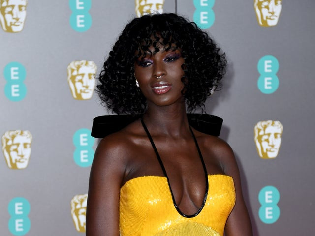 Kinh ngac nguoi mau Anh dung sua chinh minh de chua mun-Hinh-2