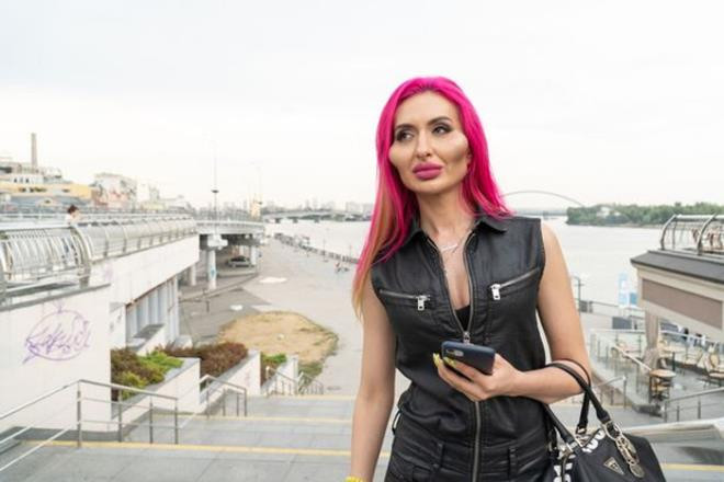 Nguoi mau co cap ma loi lom kinh di vi nghien tiem filler-Hinh-2