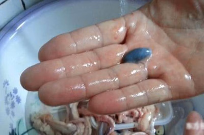 Đã có rất nhiều trường hợp bệnh nhân nuốt mật cá trắm đã bị ngộ độc cấp, thậm chí là tử vong. Do đó khi làm thực phẩm cần rửa thật sạch, nấu nướng kỹ, tốt nhất nên bỏ mật, lòng cá.