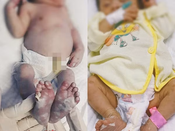 Be so sinh o Nghe An mac benh giang mai