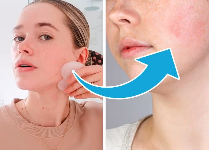 Đá gua sha massage làm mịn da: Massage da bằng đá gua sha giúp cải thiện lưu thông máu, giảm đau cổ, vai nhưng việc chà xát quá mạnh có thể khiến các mạch máu nhỏ gần bề mặt da bị vỡ, dẫn đến bầm tím và chảy máu dưới da.