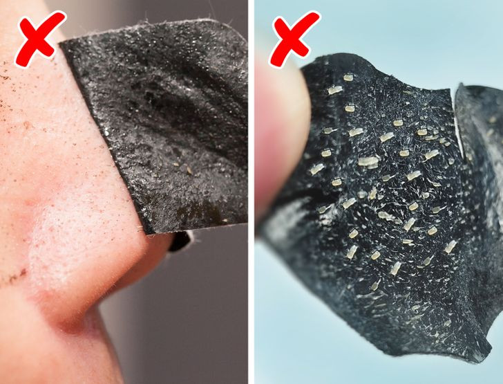 Miếng lột mụn đầu đen: Miếng lột mụn có thể giúp loại bỏ mụn đầu đen ở cánh mũi cũng như làm sạch lỗ chân lông và tế bào da chết. Tuy nhiên, nó cũng lấy đi lớp dầu tự nhiên trên da, khiến tiết nhiều dầu hơn, đồng thời, lỗ chân lông bị nở rộng dễ tiếp xúc với bụi bẩn, tạo thành mụn. Ảnh: BS.