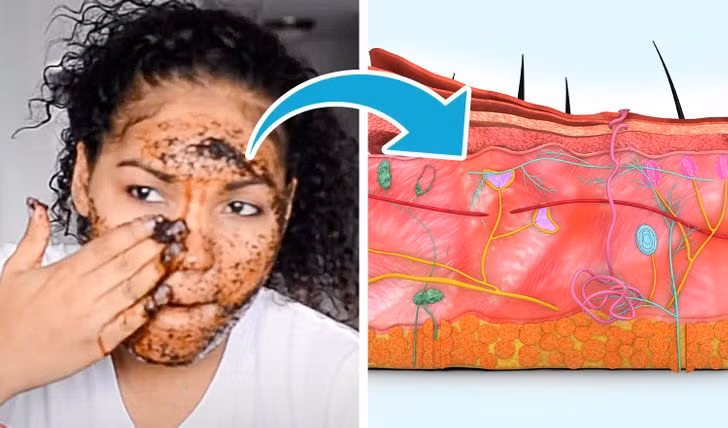 Tẩy da chết dạng hạt thô: Sản phẩm làm đẹp này thường có tính bào mòn cao, có thể loại bỏ hoàn toàn lớp da chết trên bề mặt da. Tuy nhiên, nó cũng lấy đi lớp dầu tự nhiên trên da, khiến da tiết nhiều dầu hơn, dễ gây bít tắc lỗ chân lông và nổi mụn.