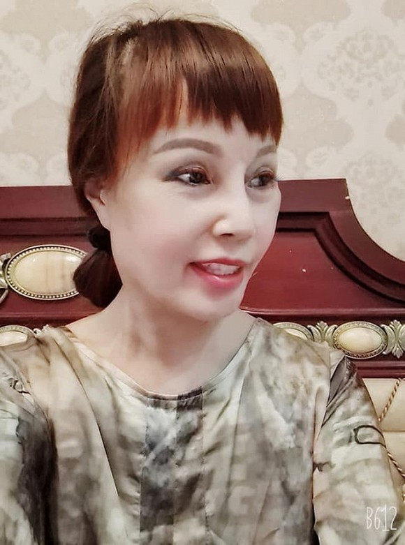 Cô dâu 62 tuổi cũng không ngần ngại chi một khoản tiền khủng để làm răng sứ, tắm trắng và hút mỡ...để có thể sở hữu nhan sắc trẻ trung hơn.