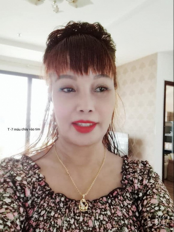 Sau khi tiến hành phẫu thuật thẩm mỹ "tân trang" lại nhan sắc để níu kéo tuổi xuân, cô dâu 62 tuổi Thu Sao liên tục gây tranh cãi vì nhan sắc của mình. Có thời gian, chị khiến nhiều người hốt hoảng vì gặp biến chứng thẩm mỹ khiến khuôn mặt méo xệch và chảy xệ, nhiều người không khỏi ngán ngẩm.