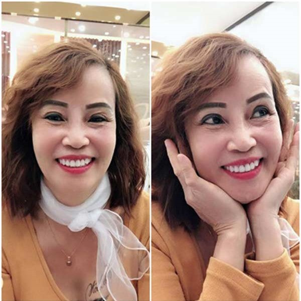 Sau thời gian ngắn điều trị biến chứng, cô dâu 62 tuổi ở Cao Bằng đã nhanh chóng lấy lại nhan sắc và thường xuyên chia sẻ hình ảnh trên trang cá nhân của mình.
