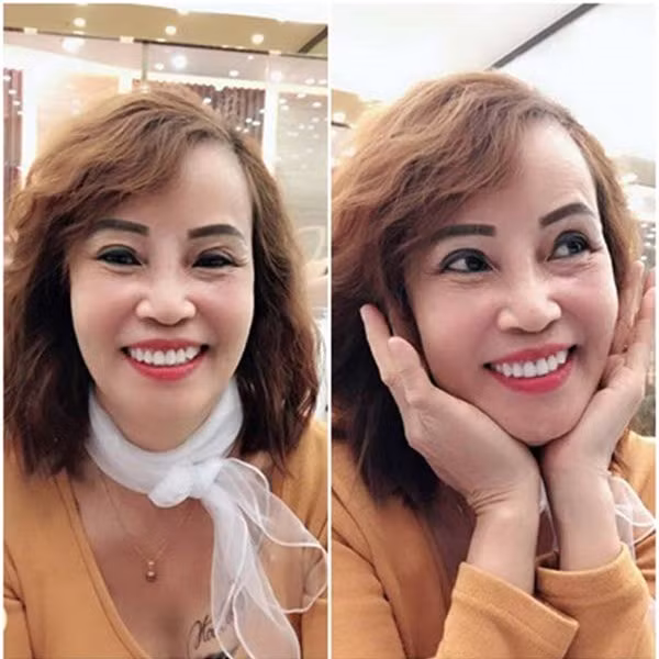 Sau thời gian ngắn điều trị biến chứng, cô dâu 62 tuổi ở Cao Bằng đã nhanh chóng lấy lại nhan sắc và thường xuyên chia sẻ hình ảnh trên trang cá nhân của mình.