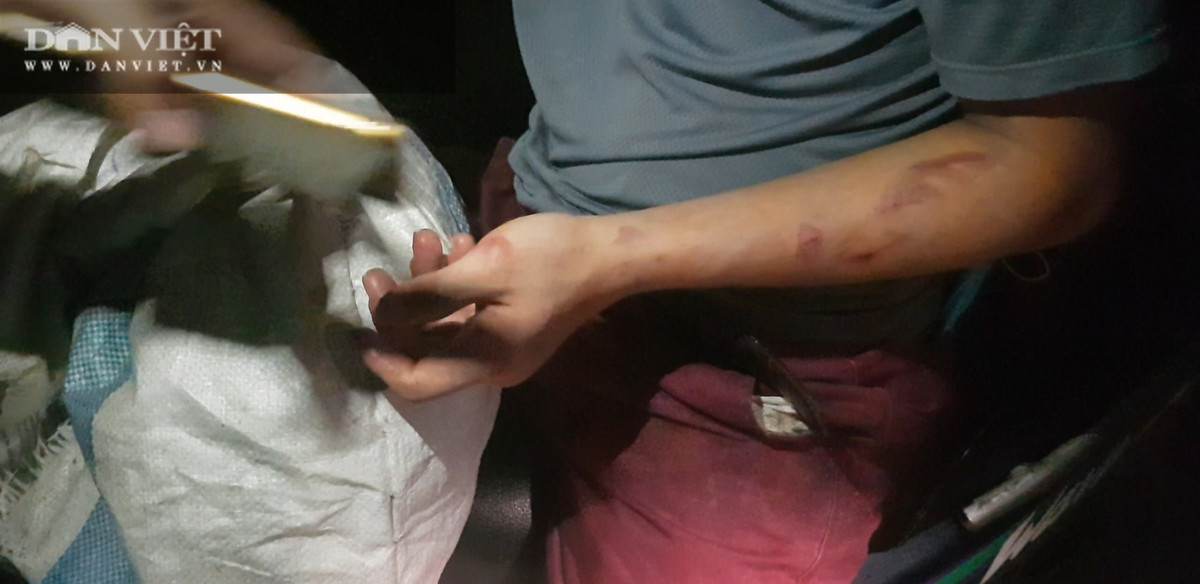 Bac Ninh: Giup viec trong quan banh xeo Mien Trung bi “tra tan nhu thoi Trung co”!-Hinh-5