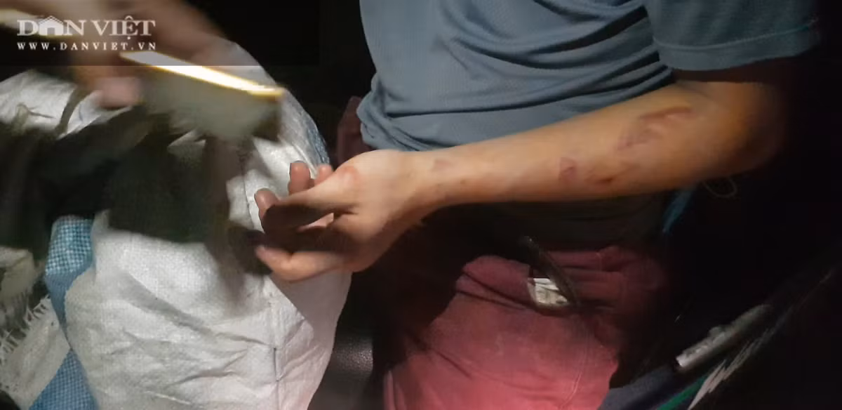 Bac Ninh: Giup viec trong quan banh xeo Mien Trung bi “tra tan nhu thoi Trung co”!-Hinh-5