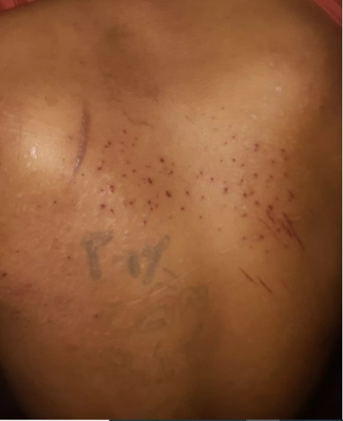 Bac Ninh: Giup viec trong quan banh xeo Mien Trung bi “tra tan nhu thoi Trung co”!-Hinh-6