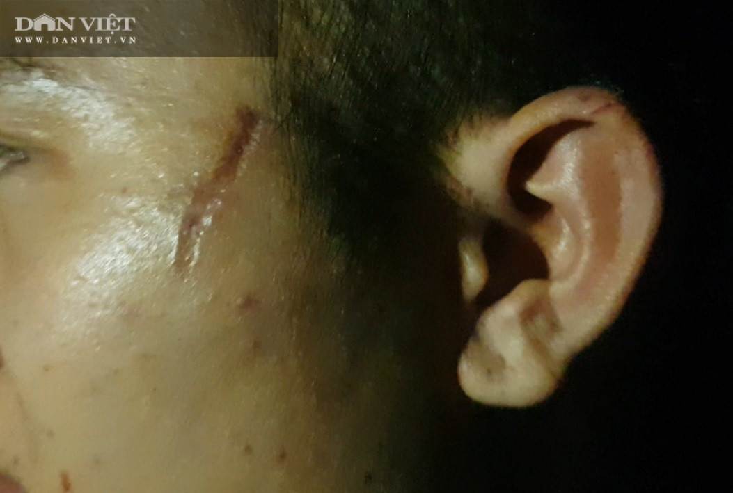 Bac Ninh: Giup viec trong quan banh xeo Mien Trung bi “tra tan nhu thoi Trung co”!-Hinh-7