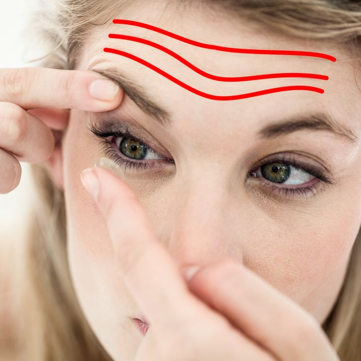 Đeo kính áp tròng: Khi bạn đeo kính áp tròng, bạn thường phải kéo căng mắt.Điều này lặp đi lặp lại khiến vùng da trán xuất hiện nếp nhăn. Không như kính cận, kính áp tròng không thể bảo vệ vùng da quanh mắt khỏi tia UV, khiến da dễ bị tổn thương. Ảnh: BS.