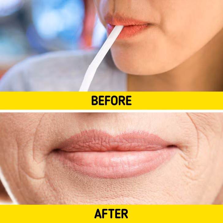Dùng ống hút: Uống cà phê hoặc trà qua ống hút có thể giúp bạn không bị ố vàng răng, nhưng nó có thể làm nếp nhăn quanh môi xuất hiện. Người dễ bị nếp nhăn quanh môi nên tránh sử dụng ống hút thực sự thường xuyên. Chuyển động cơ bắp lặp đi lặp lại sẽ phá vỡ collagen quanh vùng miệng, làm hình thành nếp nhăn sâu.