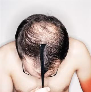 Sử dụng dầu dừa: Dùng dầu dừa thoa lến khắp da đầu và mát xa nhẹ nhàng từ chân tóc. Cách làm này sở dĩ rất công hiệu bởi trong dừa có chứa một lượng lớn các dưỡng chất chất cần thiết để nuôi dưỡng mái tóc. Bên cạnh đó, bạn có thể dùng viên nén vitamin E thay thế cho dầu dừa cũng đem lại hiệu quả tương tự.