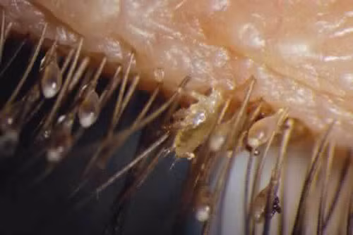 Hang chuc con ran mu tren mat be 4 tuoi