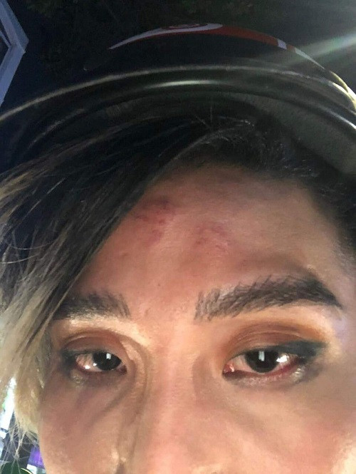 Bi to danh nguoi mau luong tinh, tai xe GO-Viet to nguoc khach chui, danh minh truoc-Hinh-2