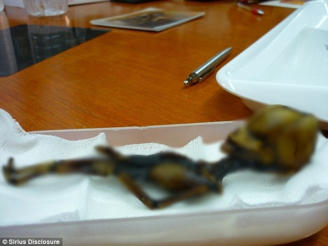 Tuy nhiên, do thời điểm đó các cơ sở y tế ở khu vực hẻo lánh của Chile chưa phát triển nên Ata không được điều trị kịp thời. Cô bé có lẽ là người Chile qua đời cách thời điểm phát hiện khoảng 40 năm.