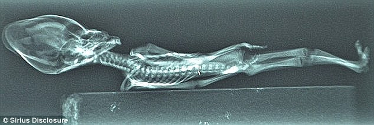 Cụ thể, các nhà nghiên cứu thuộc Đại học Stanford xác định xác ướp Ata là thi hài của con người sau khi phân tích bộ gene.