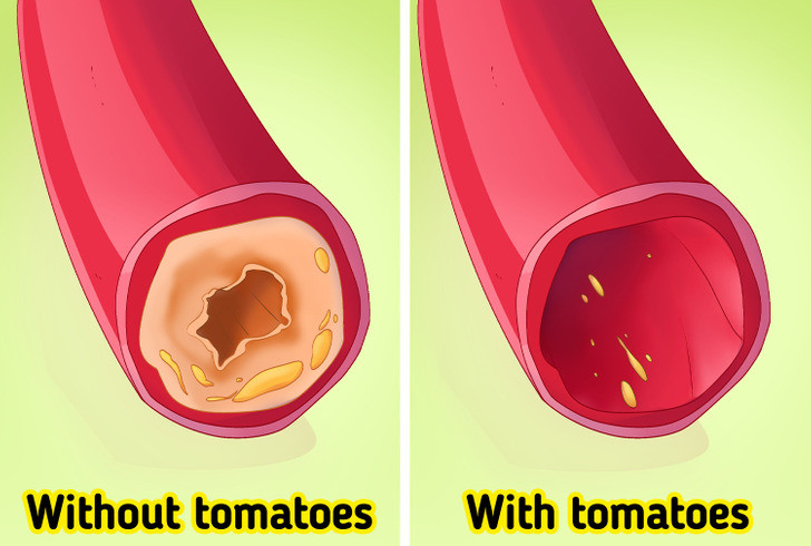2. Cà chua tốt cho tim: Lycopene là một chất chống oxy hóa có thể bảo vệ các tế bào của cơ thể. Một số nghiên cứu cho thấy con người tiêu thụ lycopene có nguy cơ bị bệnh tim mạch, tiểu đường và đột quỵ thấp hơn. Ảnh: Shutterstock.