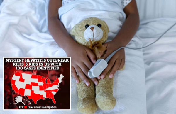 Benh viem gan bi an bung phat o My, 5 tre tu vong