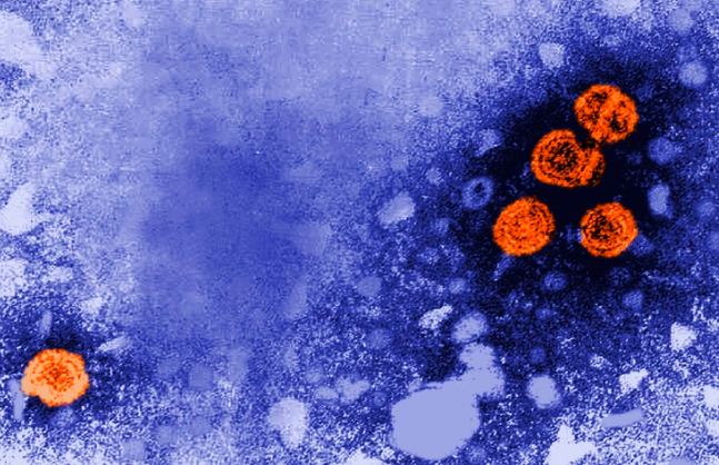 Lo ngai benh viem gan bi an, Viet Nam giam sat cac ca nghi ngo