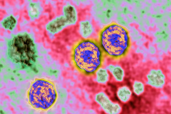 Gia thuyet moi gay soc ve nguyen nhan bung phat viem gan bi an