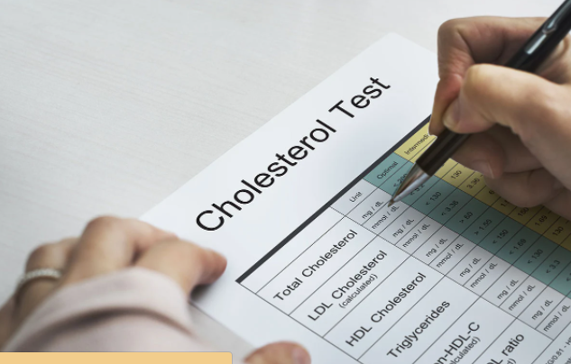 5. Ăn bơ có thể làm giảm cholesterol "xấu": Theo các nhà nghiên cứu, một quả bơ mỗi ngày thực sự có thể giữ cho mức cholesterol của bạn ở mức ổn định. Một nghiên cứu của Mỹ được thực hiện trên 45 người thừa cân cho thấy, ở những người ăn kiêng có bơ, lượng Lipoprotein tỷ trọng thấp (LDL), hay cholesterol "xấu", thấp hơn 13,5 mg/dL so với ở nhóm có chế độ ăn ít chất béo nhưng không có bơ. Ảnh: Shutterstock.