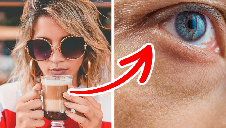 4. Có thể khiến làn da lão hóa nhanh hơn: Mặc dù cà phê rất giàu chất chống oxy hóa giúp bảo vệ làn da của bạn khỏi các gốc tự do có hại, nhưng uống quá nhiều cà phê có thể làm giảm lượng collagen trong tế bào của của cơ thể. Ảnh: BrightSide.