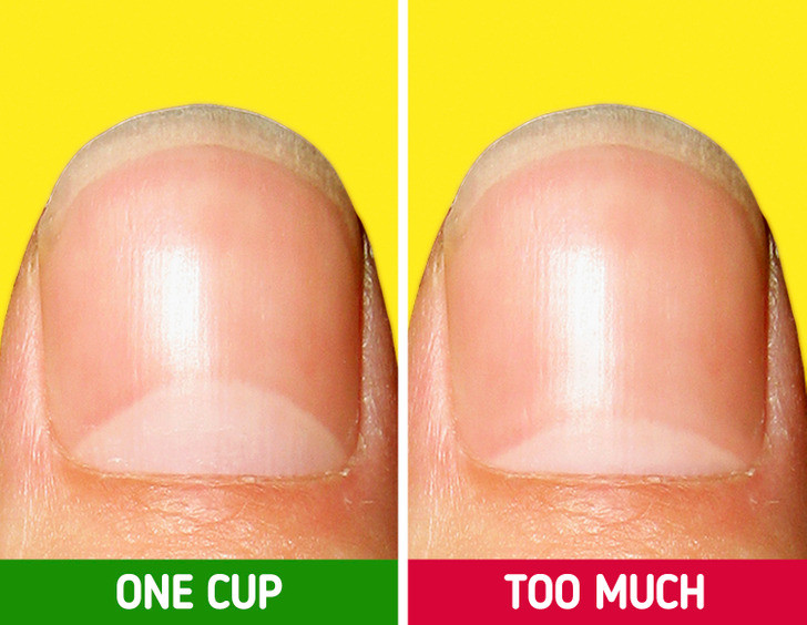 1. Có thể gây thiếu máu, mệt mỏi: Ngoài việc khiến bạn cảm thấy bồn chồn, uống quá nhiều cà phê có thể cản trở sự hấp thụ sắt của cơ thể và gây thiếu máu. Ảnh: BrightSide.