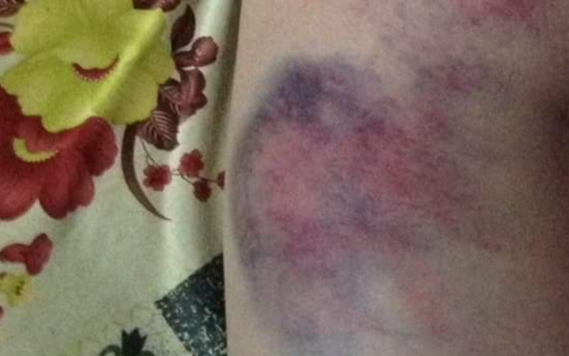 Vet thuong bam tim cua hoc lop 4 o Dak Lak do dau?