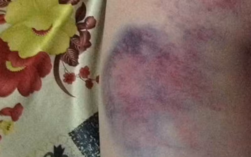 Vet thuong bam tim cua hoc lop 4 o Dak Lak do dau?