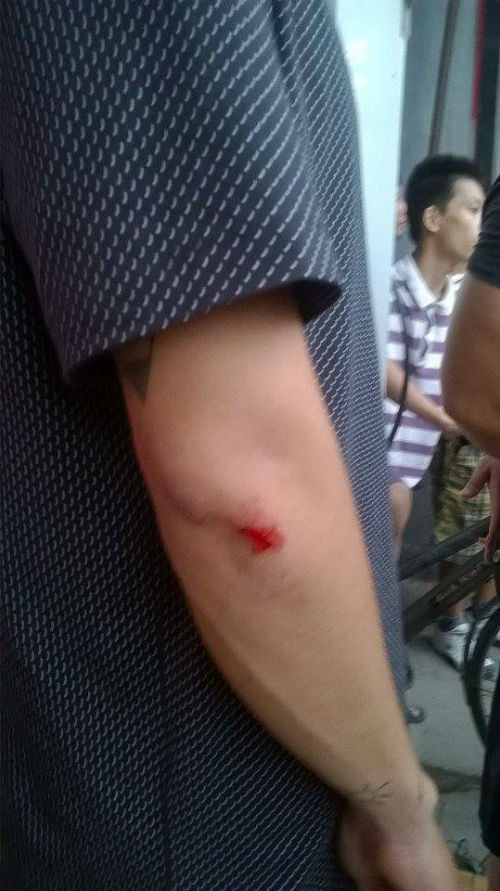 Rất may anh Hoàng chỉ bị xây sát nhẹ ở cánh tay.